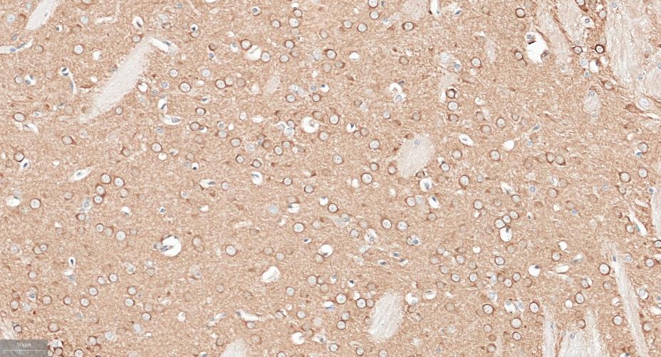 衔接因子蛋白含pH域蛋白1重组兔单抗