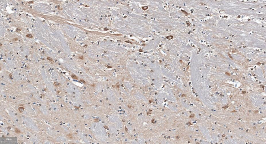 γ-氨基丁酸受体相关蛋白重组兔单抗