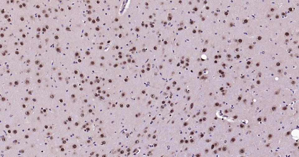 蛋白激酶B重组兔单抗