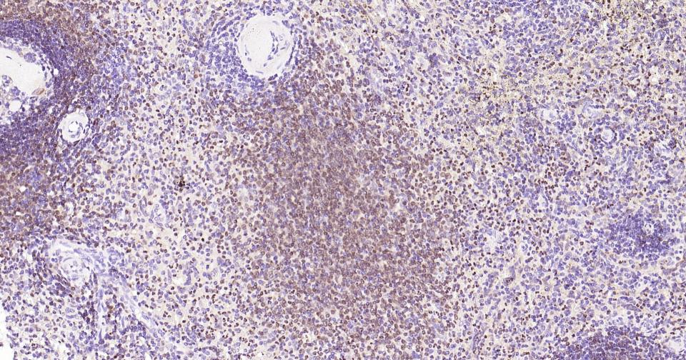 5-脂氧合酶重组兔单抗