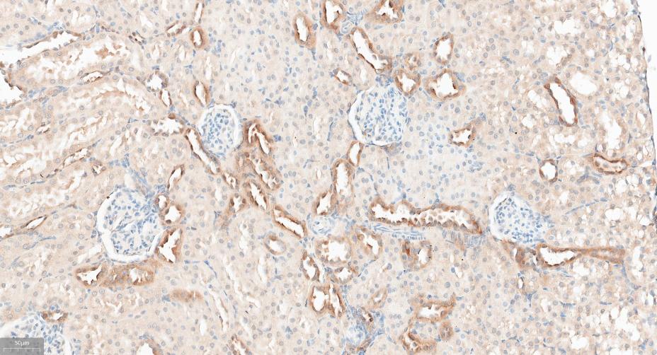 γ-氨基丁酸受体相关蛋白重组兔单抗