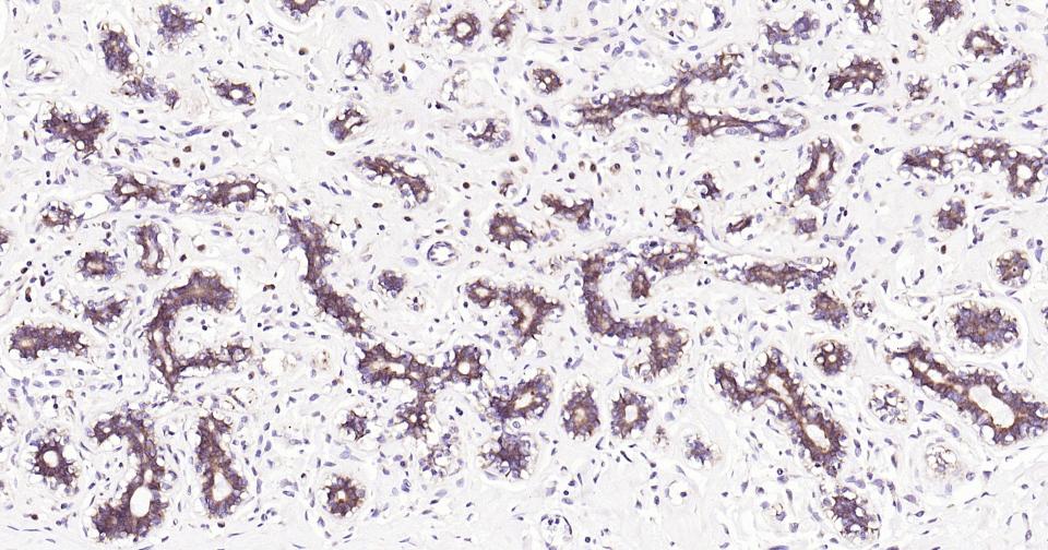 eIF2B蛋白重组兔单抗-bsm-61011R