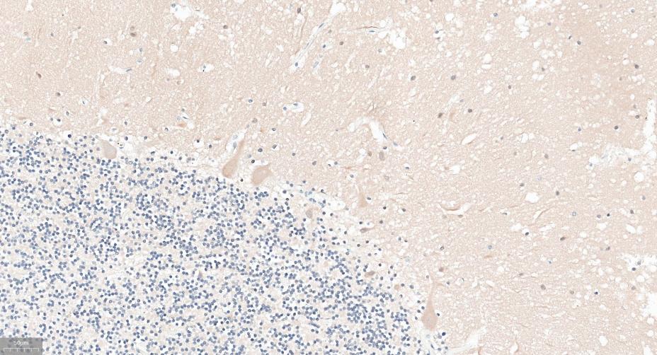 γ-氨基丁酸受体相关蛋白重组兔单抗