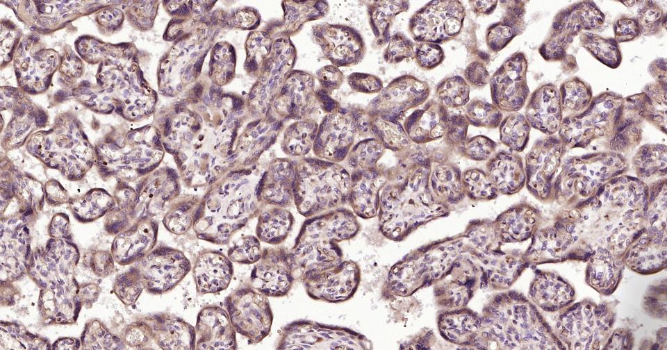 基质金属蛋白酶-12抗体-bs-1854R