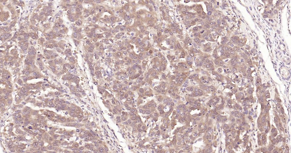 干扰素调节因子3重组兔单抗