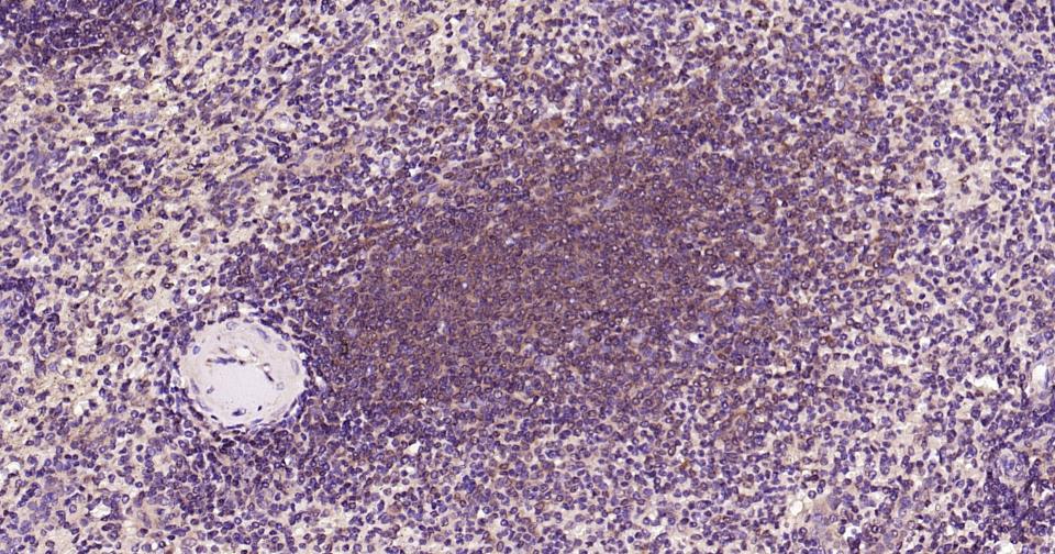 干扰素调节因子3重组兔单抗