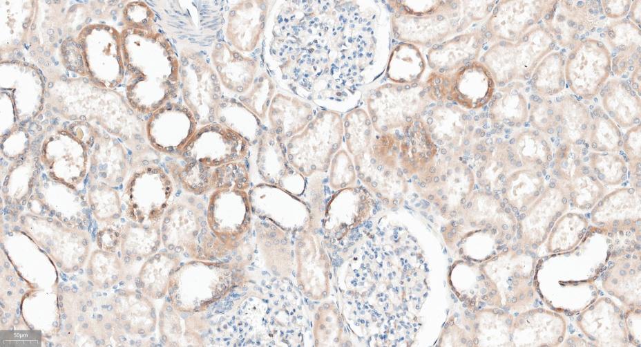 γ-氨基丁酸受体相关蛋白重组兔单抗