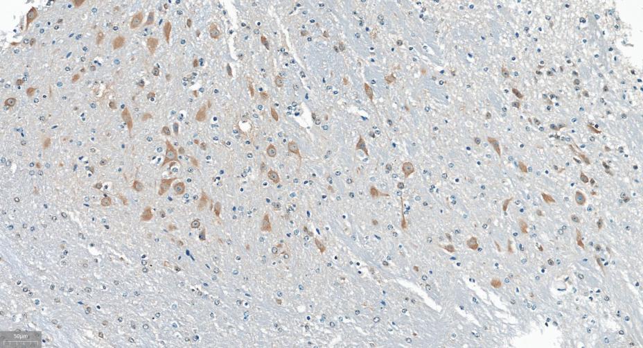γ-氨基丁酸受体相关蛋白重组兔单抗