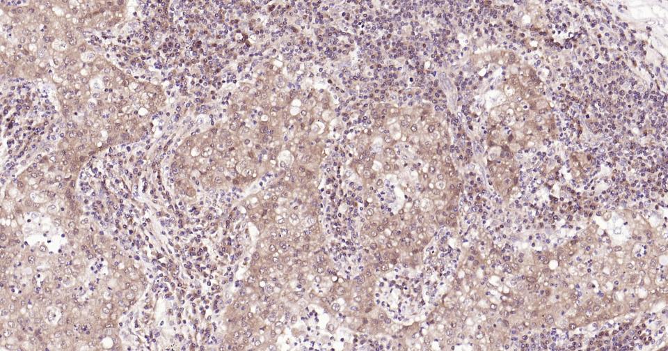 干扰素调节因子3重组兔单抗