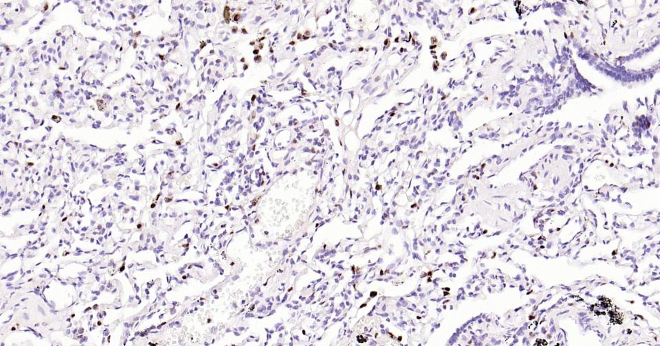 5-脂氧合酶重组兔单抗
