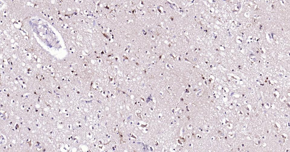 蛋白激酶B重组兔单抗