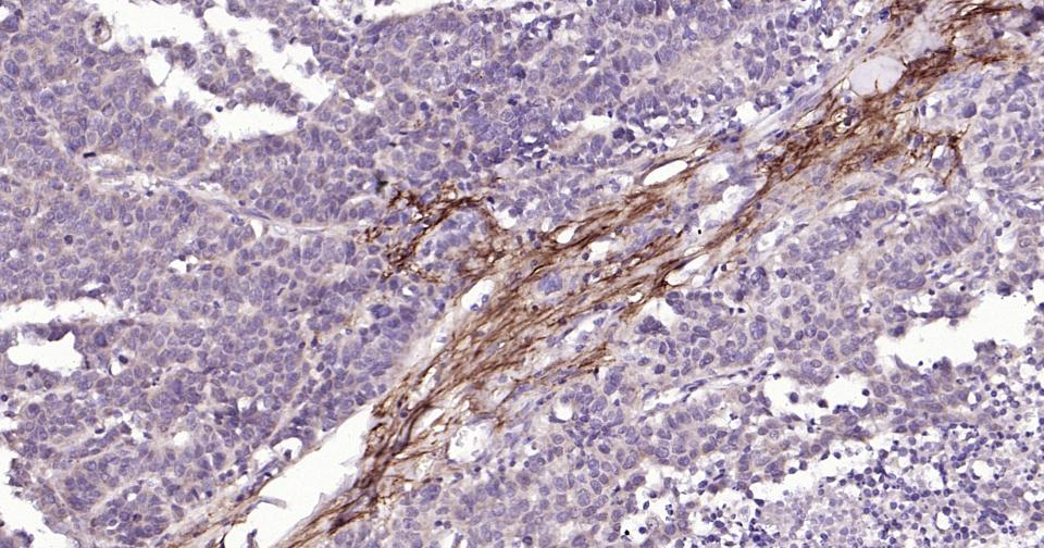 基质金属蛋白酶-12抗体-bs-1854R