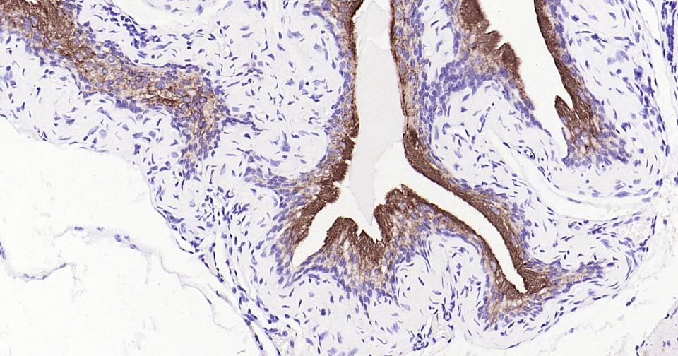 尿路上皮特异蛋白3重组兔单抗