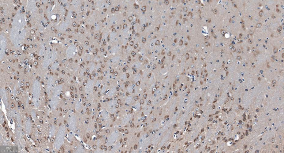 γ-氨基丁酸受体相关蛋白重组兔单抗