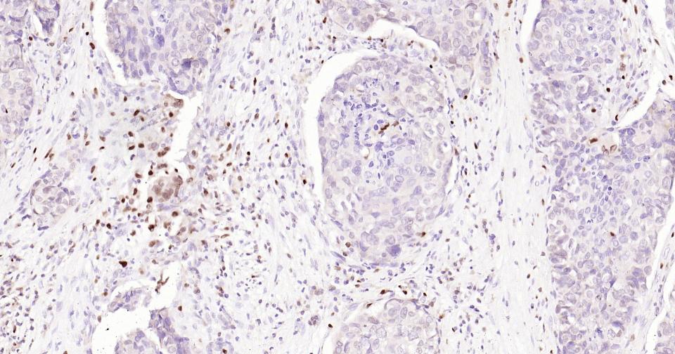 5-脂氧合酶重组兔单抗