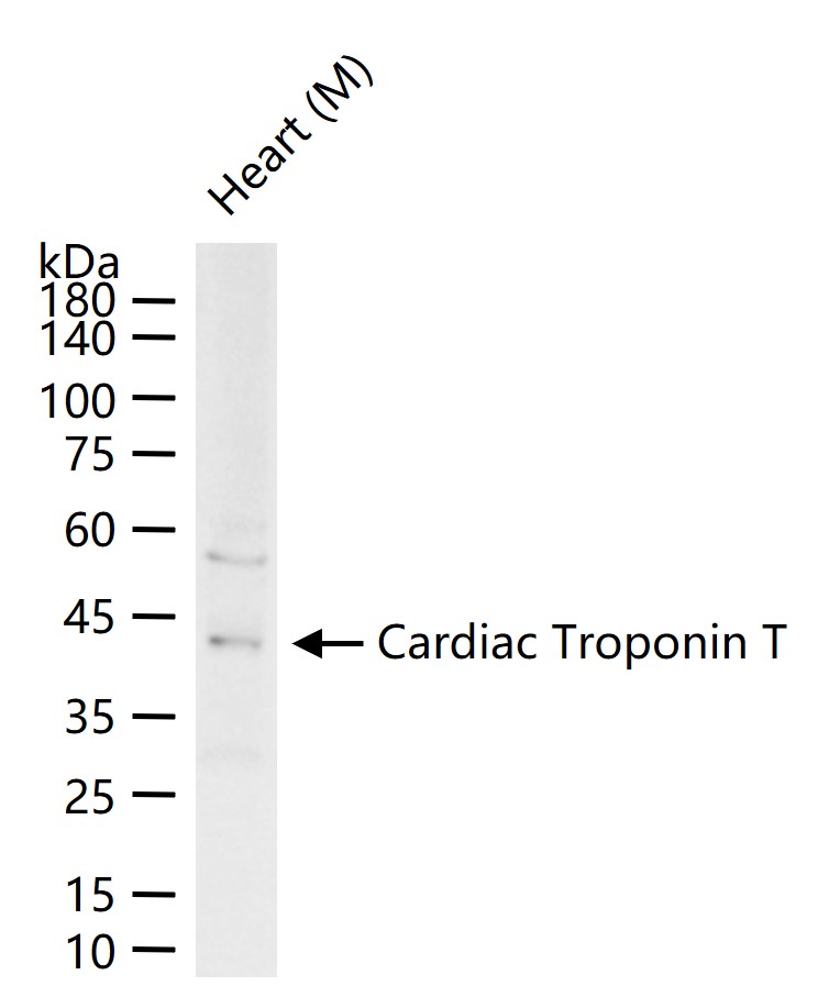 Cardiac Troponin T Rabbit pAb (一抗) - WB | Bioss