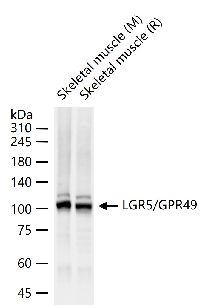 蛋白偶联受体49重组兔单抗