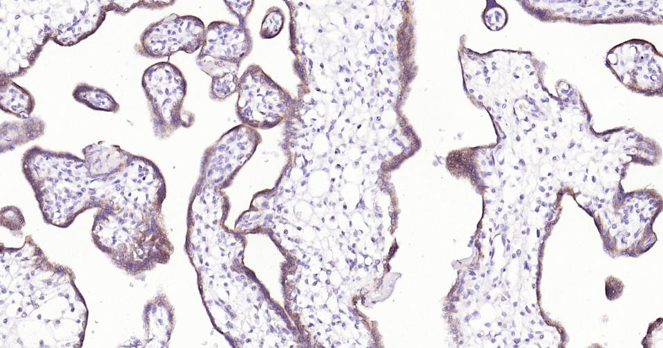 糖蛋白gp330重组兔单抗