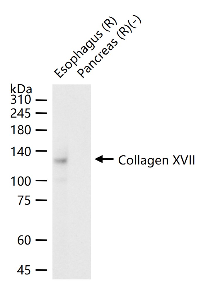 胶原蛋白17重组兔单抗
