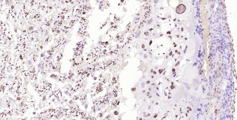 磷酸化组蛋白H2AX重组兔单抗