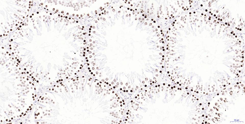 磷酸化组蛋白H2AX重组兔单抗