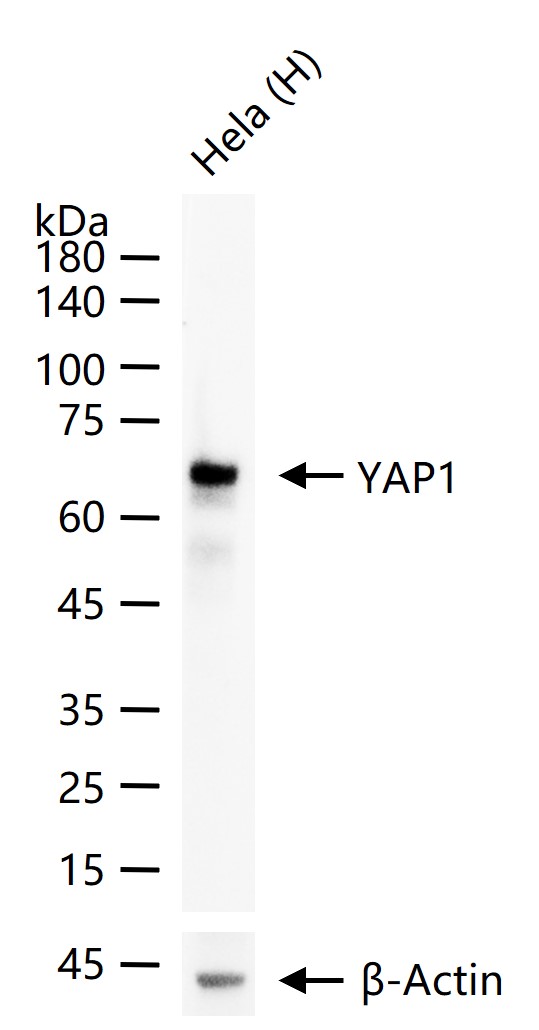 原癌基因Yes相关蛋白1重组兔单抗