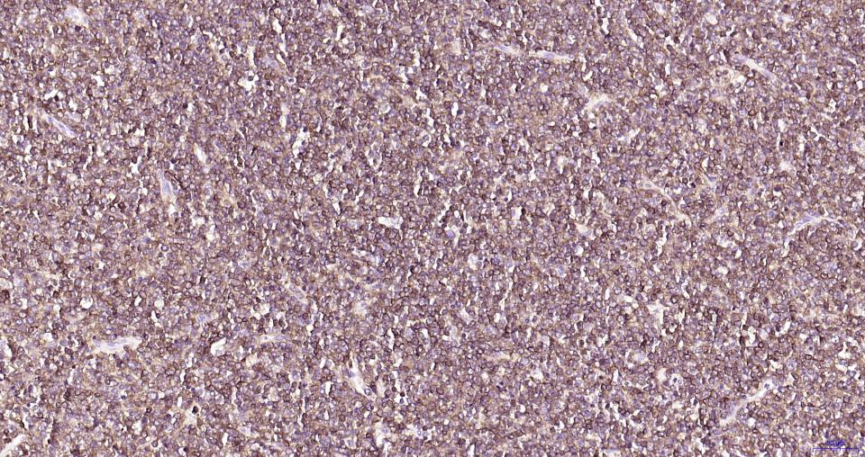 CD79A重组兔单克隆抗体