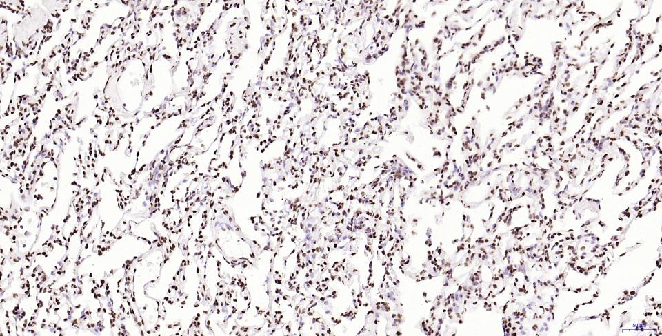 组蛋白H2AX重组兔单抗