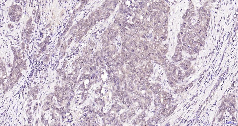 磷酸化蛋白激酶B重组兔单抗