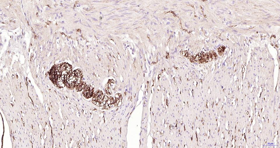 小鼠抗人CD56 (NCAM)单克隆抗体-bsm-30046M