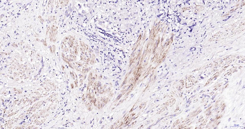 NCAM Mouse mAb (一抗) - IHC-P,IHC-F,IF,Flow-Cyt | Bioss