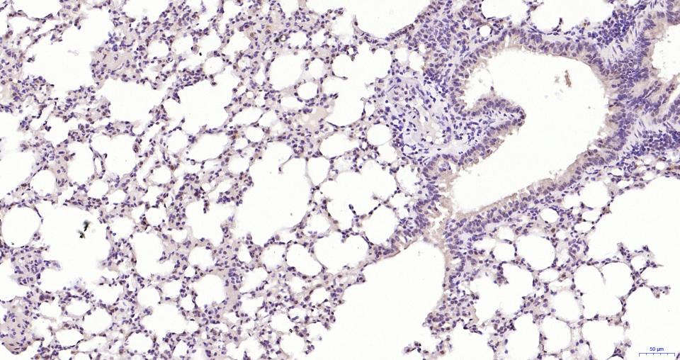 磷酸化蛋白激酶B重组兔单抗