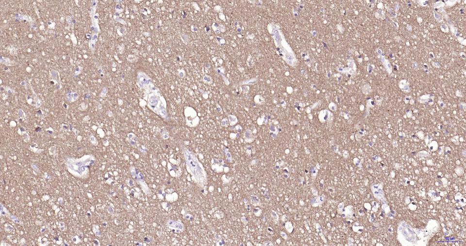 小鼠抗人CD56 (NCAM)单克隆抗体-bsm-30046M