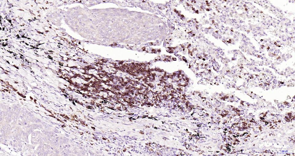 CD79A重组兔单克隆抗体