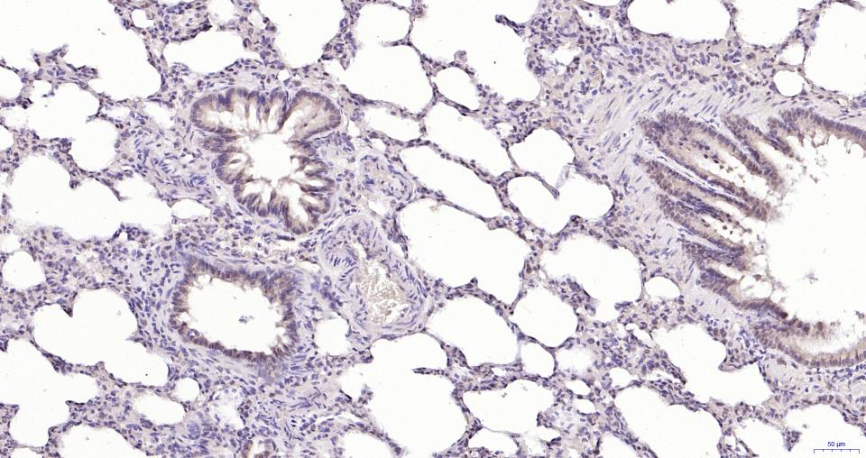 磷酸化蛋白激酶B重组兔单抗