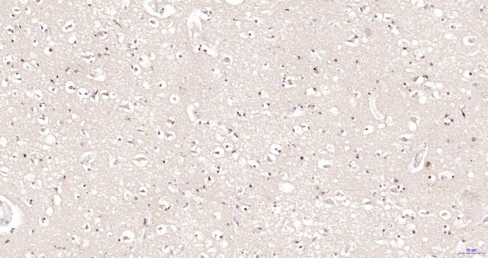 磷酸化蛋白激酶B重组兔单抗