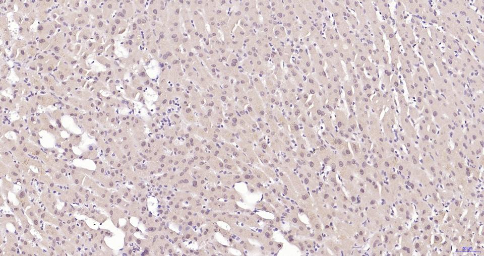 磷酸化蛋白激酶B重组兔单抗