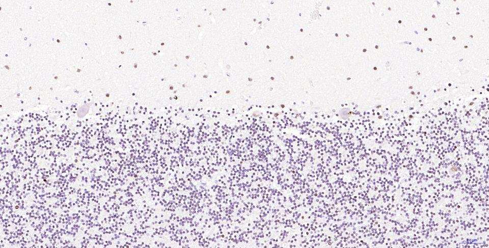 磷酸化组蛋白H2AX重组兔单抗