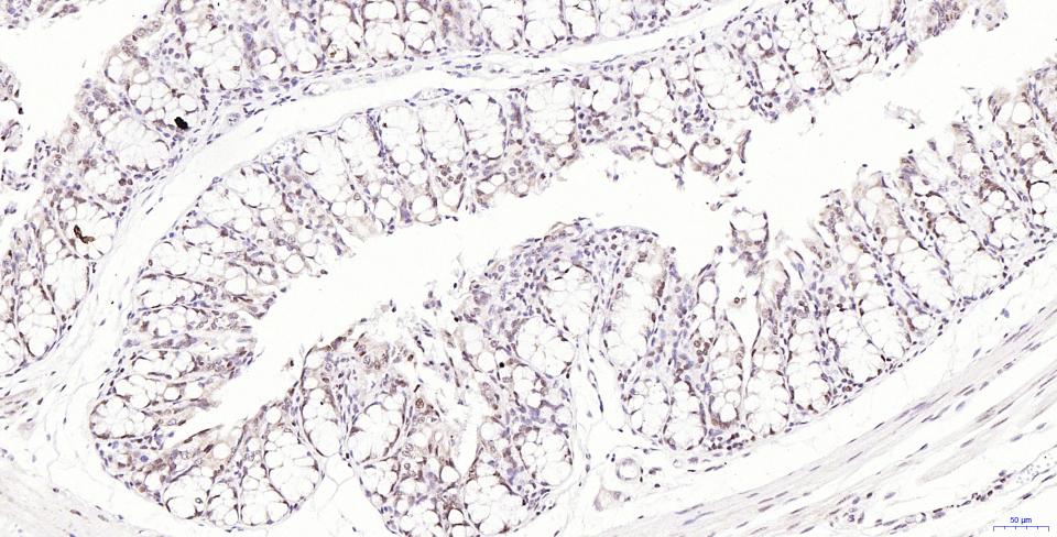 磷酸化组蛋白H2AX重组兔单抗