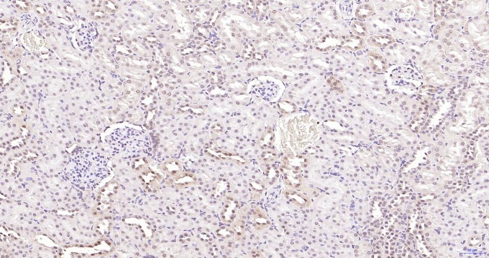 磷酸化蛋白激酶B重组兔单抗