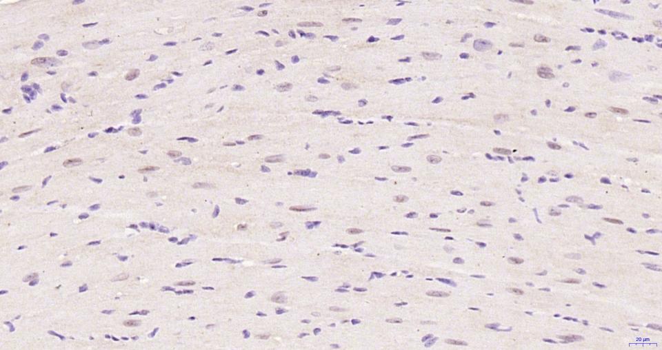 磷酸化蛋白激酶B重组兔单抗