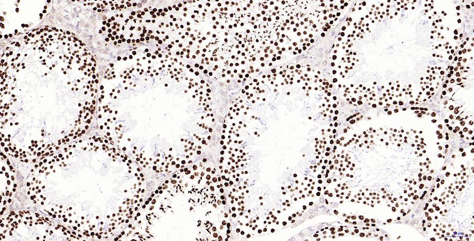 磷酸化组蛋白H2AX重组兔单抗