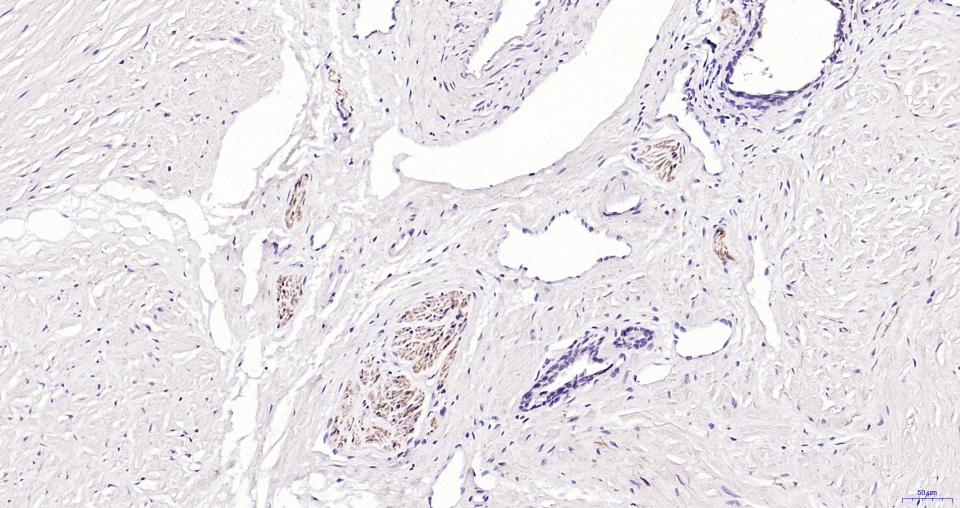 小鼠抗人CD56 (NCAM)单克隆抗体-bsm-30046M