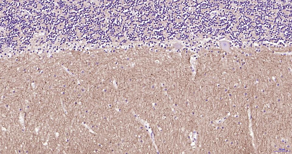 小鼠抗人CD56 (NCAM)单克隆抗体-bsm-30046M