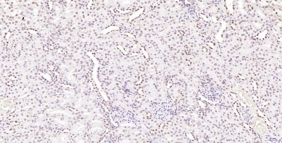 磷酸化组蛋白H2AX重组兔单抗