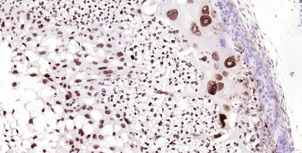 磷酸化组蛋白H2AX重组兔单抗