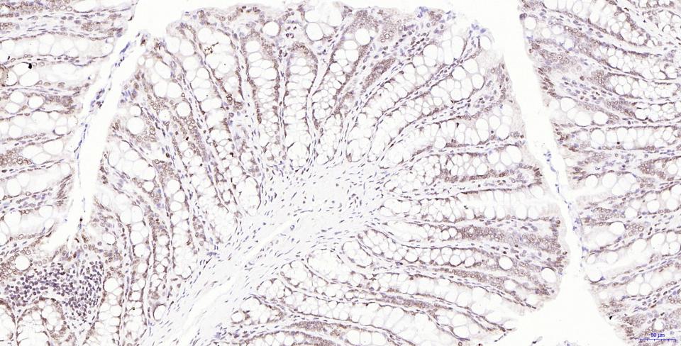 磷酸化组蛋白H2AX重组兔单抗