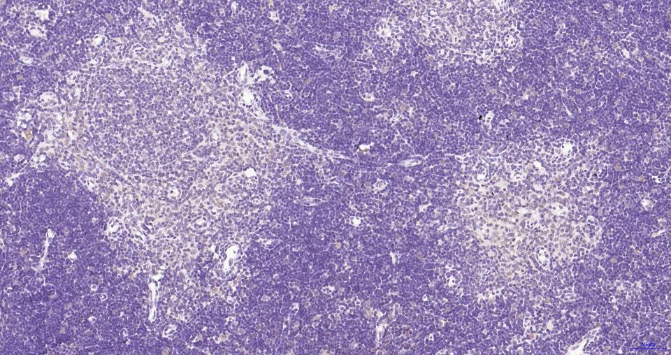 磷酸化蛋白激酶B重组兔单抗