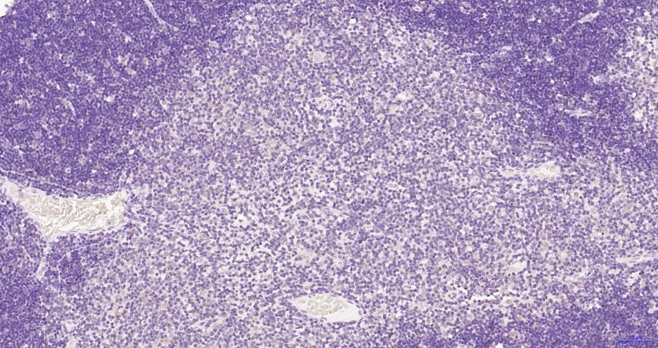 磷酸化蛋白激酶B重组兔单抗