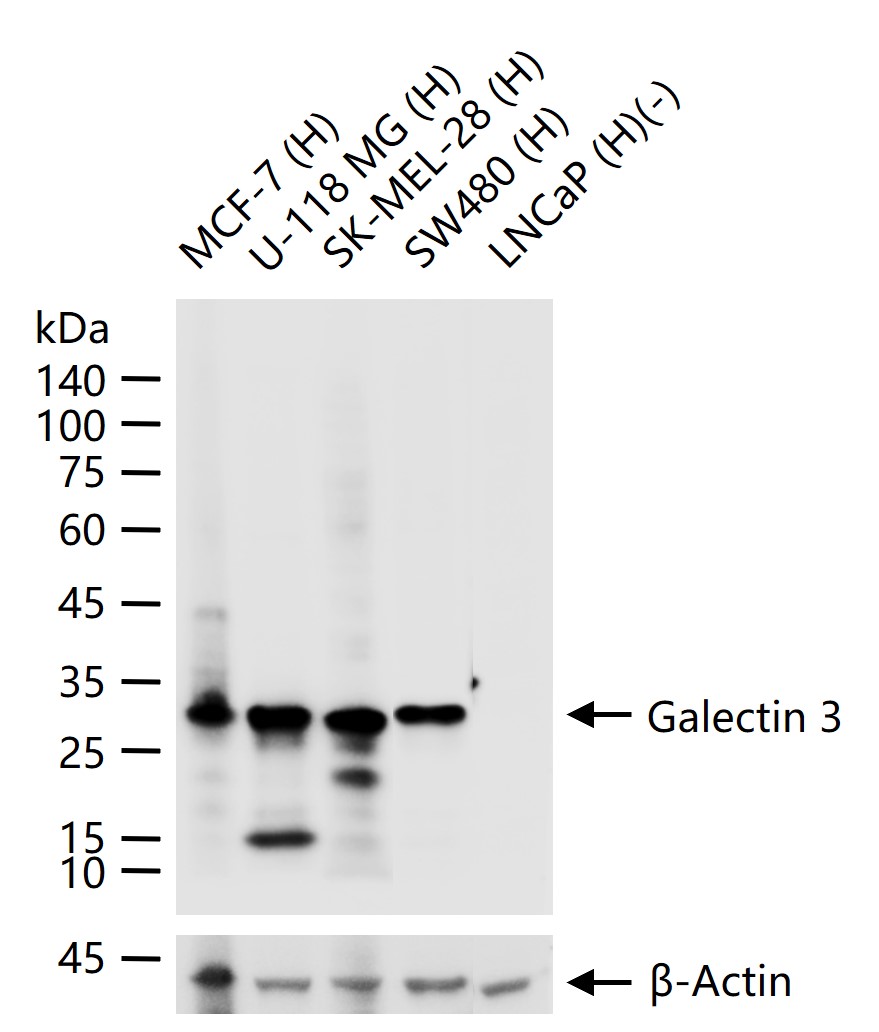 半乳糖凝集素3重组兔单抗